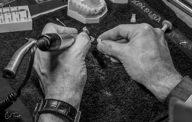 Hands-on demonstration – preparation on a model