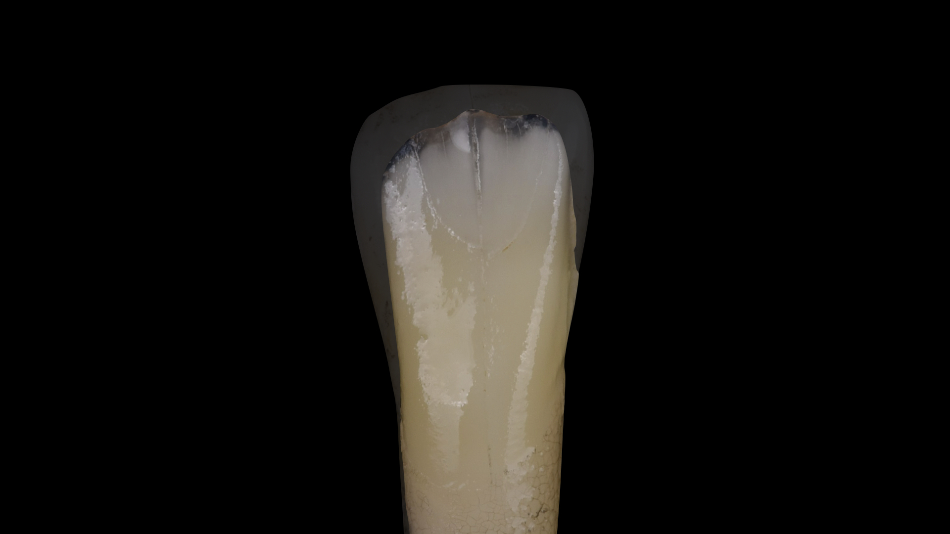Single tooth – optical study