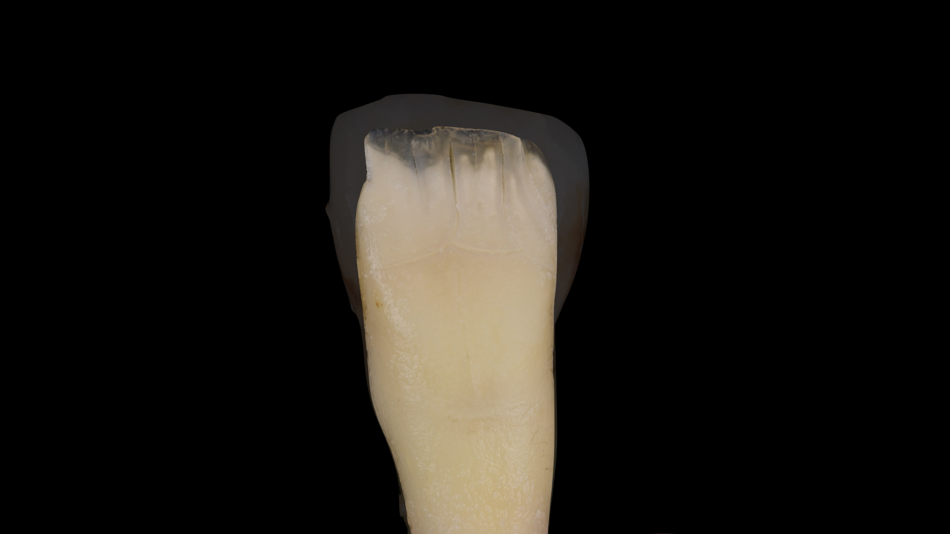 Single tooth – optical study